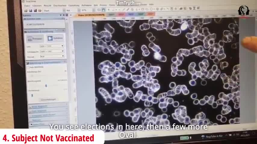 Worm Eggs Found In Vials of Convid-19 Shots