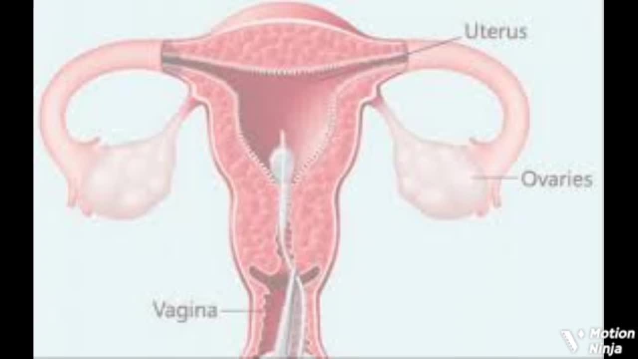Infertility treatment series -part 2 women infertility diagnosis