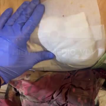 Russian soldier recieves medical treatment for large laceration on his back from shrapnel