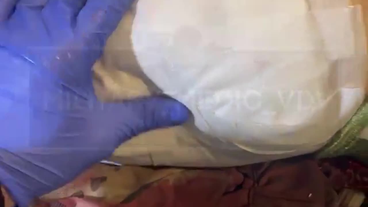 Russian soldier recieves medical treatment for large laceration on his back from shrapnel