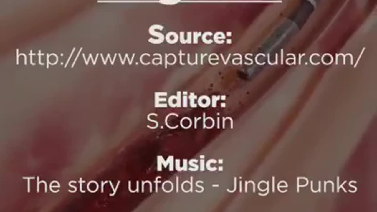 Removing blood clots within surgery now possible…