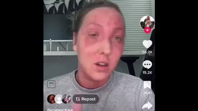 Vaccine injuries part 65