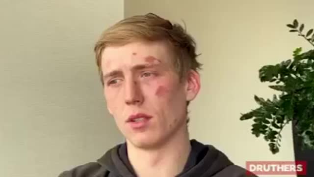 The police has beaten young man during his arrest