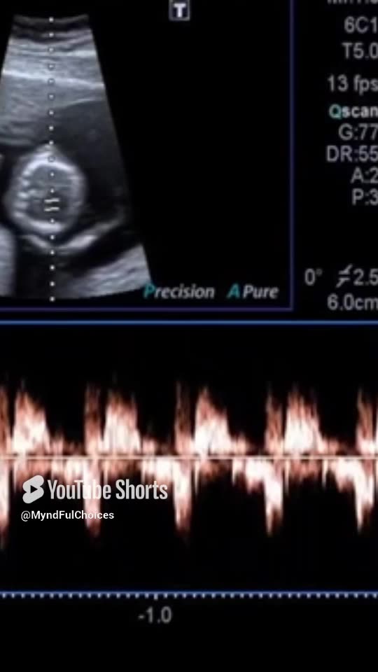 Birth Doesn't Make You Alive