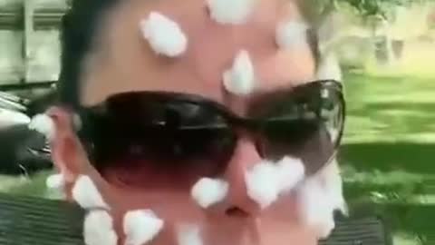 Sheep Pox