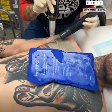 Removing tattoo with a laser