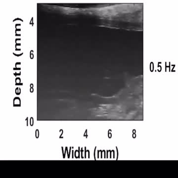 Nanorobots....Serviranno per curare??