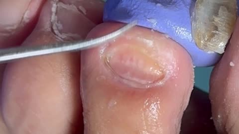 Satisfying pedicure video😋
