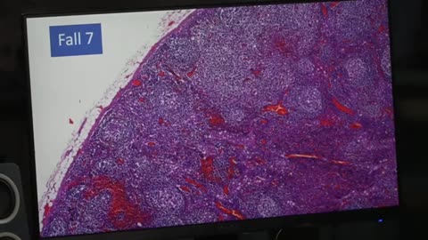 DEADLY COVID VACCINES REPORTED BY GERMAN SCIENTISTS