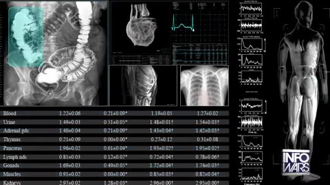 Bowne Report - Ivermectin Can't Be Stopped
