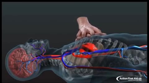 How to do proper CPR