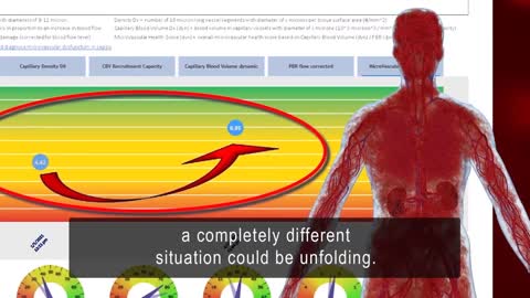 GlycoCheck Assesses Endothelial Glycocalyx Health