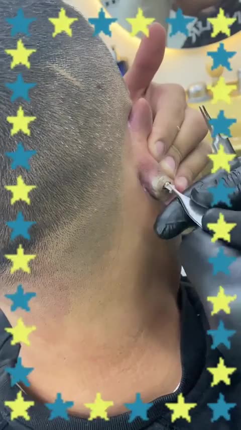 What in the world is this?