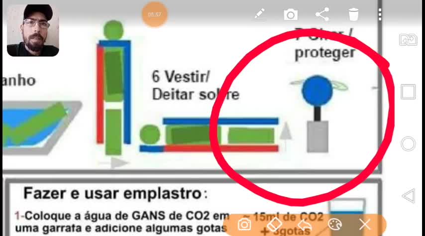 49-Primeiros Socorros Plasmáticos usando o Sistema (K.B.C.C.)