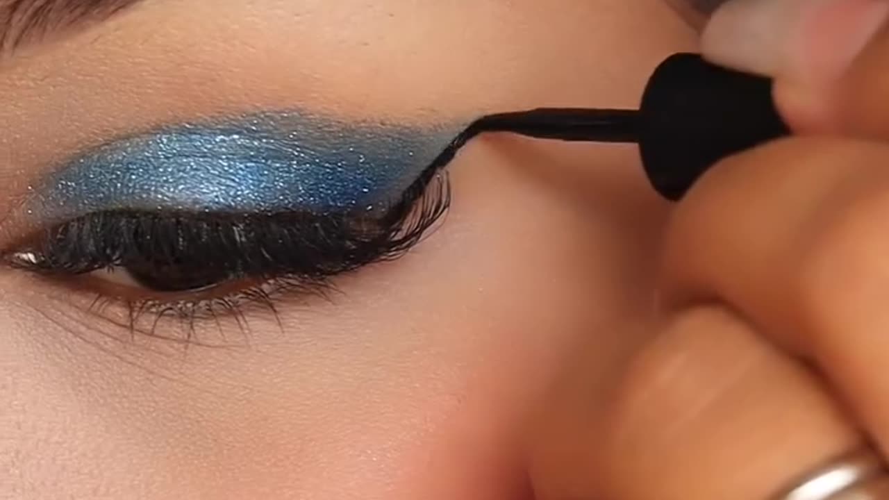 Eye