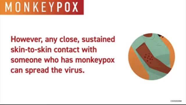 CDC Monkey pox