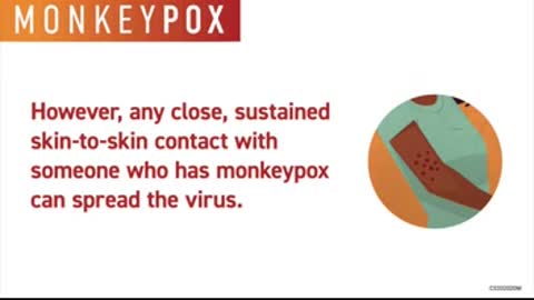 CDC Monkey pox