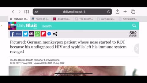 MONKYHIVAIDS GMS Watchmen repost