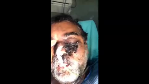 Side Effects Flesh Eating?