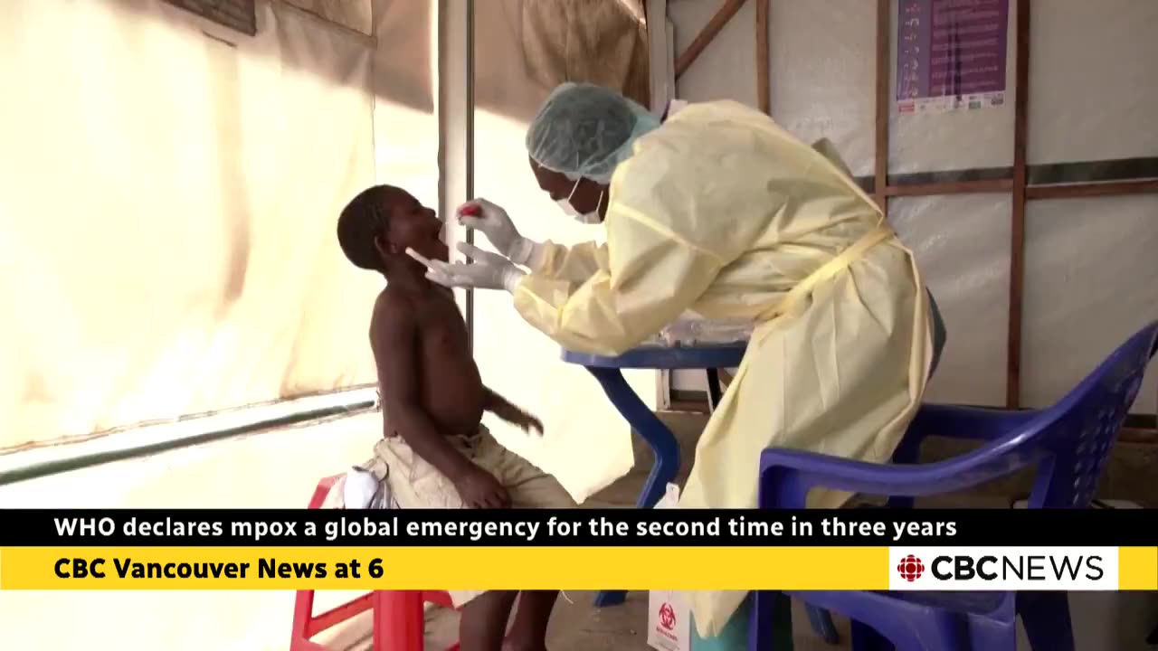 WHO declares mpox a global emergency for second time in 3 years