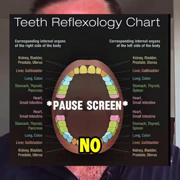 Wisdom Teeth Removal?