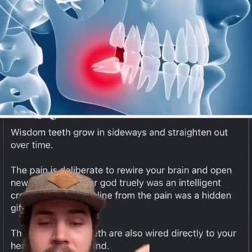 Do not remove wisdom teeth❗️