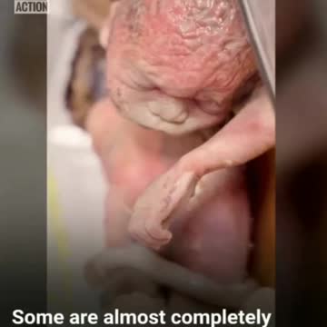 ⚠️"CAUTION SENSITIVE MATERIAL"⚠️"UNDERCOVER ABORTION INVESTIGATION LEAVES YOU HORRIFIED"⚠️