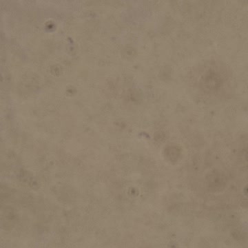 Moderna vaccine microscopic findings