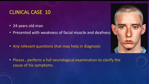 ST5.24 year old man with hearing loss and inability to smile