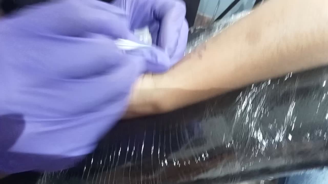 Tattooing