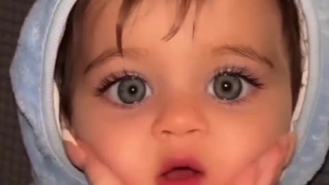 Cute baby rare eyes 👀💗