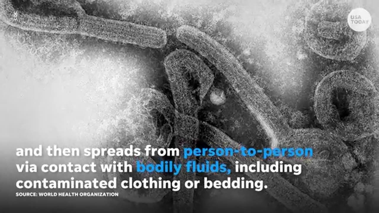 Covid is activated by 5G and has an Ebola strand in it