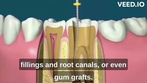 Let This Soft Mineral Melt In Your Mouth To Rebuild Gums and Teeth