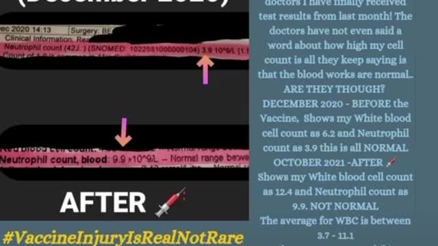 Vaccine injury report 2022-02-15