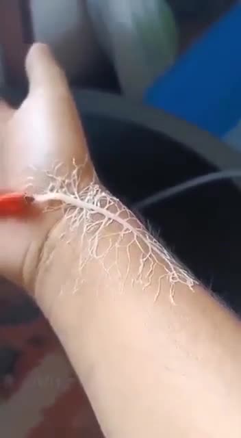 how parasites in the food supply tap into the nervous system