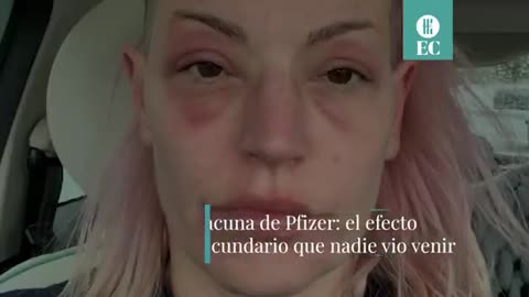 Vacuna Pfizer Covid _ el efecto secundario que nadie vio venir