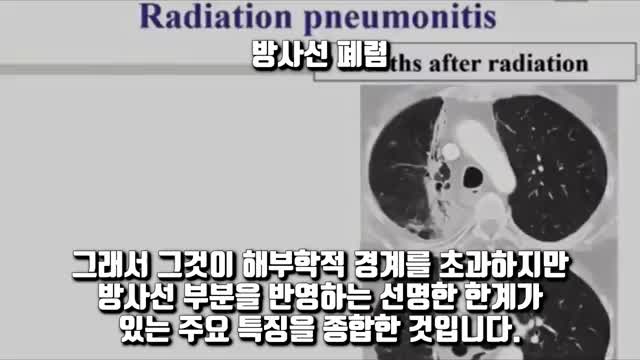 5G 방사능 질환 증상