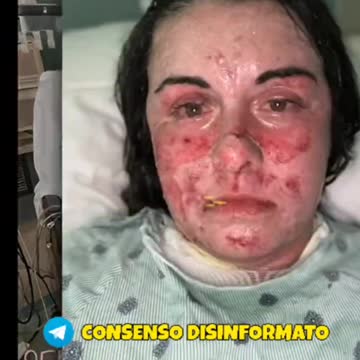 IL VACCINO È SICURO...