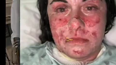 IL VACCINO È SICURO...