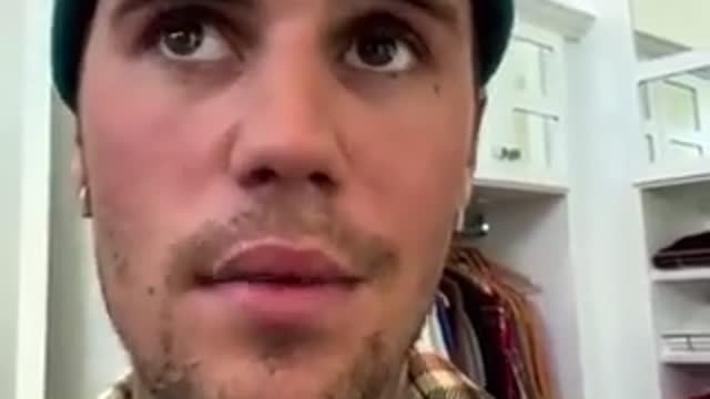 Justin bieber appears to have Bell's Palsy and PFIZER SYNDROME from the jab