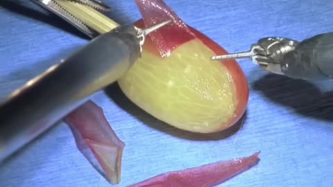 Inside the da Vinci Surgical System: Peeling a Grape