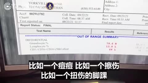 一個醫生自費為病患做了疫苗後詳細的血液檢驗，發現第一、二劑後血液的淋巴細胞，粒腺體、殺手細胞的抵抗力全部受影響。