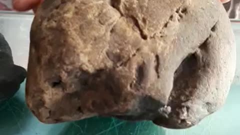 Petrified Hearts and Kidneys