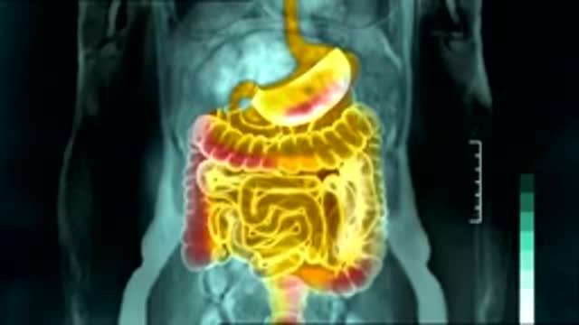 Why farting is good for you