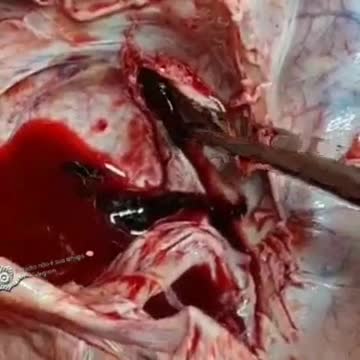 MIREN LO QUE CAUSAN LAS LLAMADAS VACUNAS