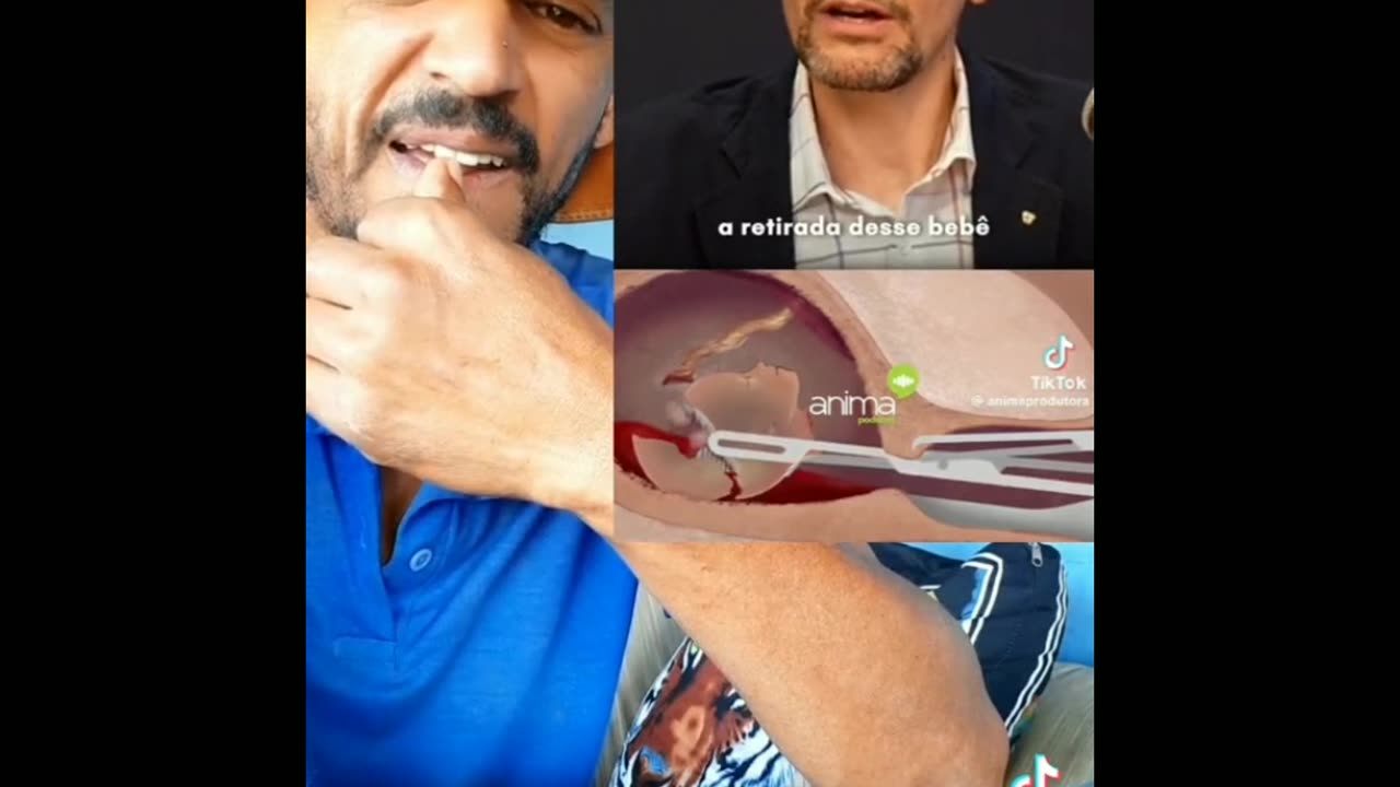 Recadinho Básico para a Galega..