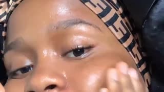 Skin care part 2