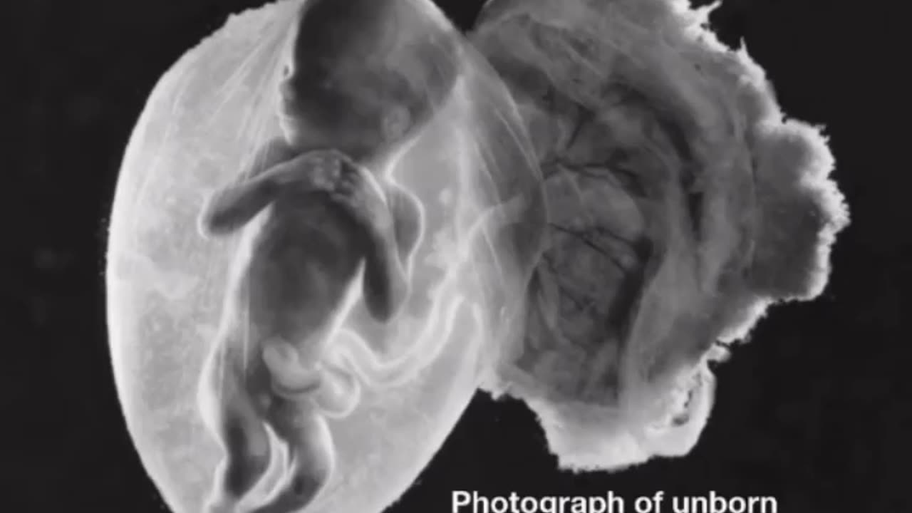 all life is important even the unborn