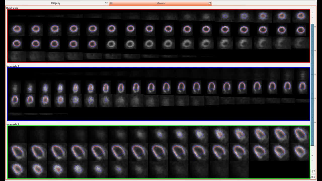 MI-Heart PET/SPECT Small Animal Cardiac Analysis Software