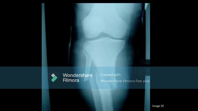 understanding orthopdic x ray